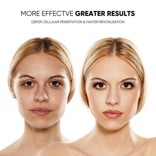 GOHIGK LED Face Mask Light Therapy Facial Photon Beauty Device with USB Cable 3 Colors LED Skin Care Treatment Mask for Facial Rejuvenation, Anti-Aging