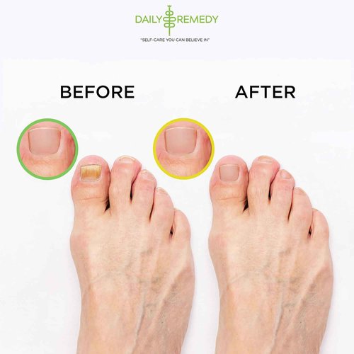 DAILY REMEDY 4-Pack Foot Soak Set - 2 Extra Strength Tea Tree Oil & 2 Citrus Detox - Made In USA - Soothes Tired Feet, Athletes Foot, Stubborn Foot Odor, Softens Calluses & Refreshes & Detoxifies