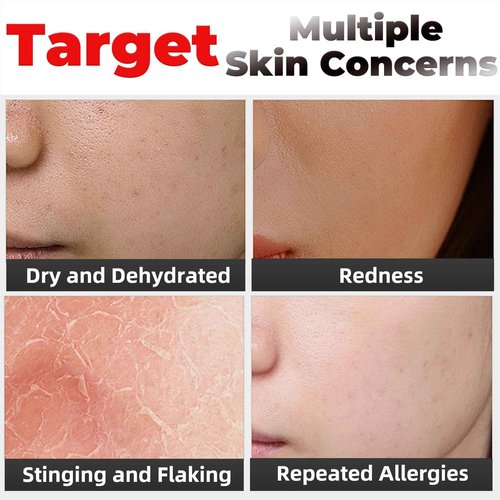 Elitzia Oxygen Facial Machine Oxygen Infusion Device Oxygen Sprayer Facial Nutrient Solution Set SPA Skincare Facial Machine Anti Aging Beauty Salon Machine 1.69fl.oz Per Bottle