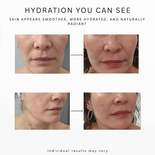 DEWI SKIN Vitamin C + Squalane Night Facial Oil – Hydrating - Nourishing Botanical Blend with Rosehip, Marula, Camellia & Bakuchiol for Soft, Glowing Skin