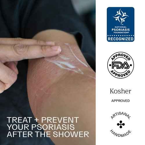 Dermabon Seborrheic Dermatitis Cream & Psoriasis Soap Bar Bundle| Calendula Extract, Salicylic Acid & Bee Wax Cream| Coal Tar soap for Dandruff Control| Moisturizing Crema para Psoriasis