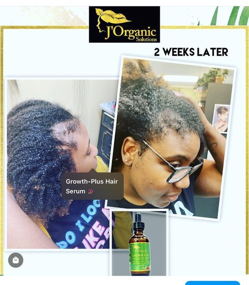 J'Organic Solutions Adult Super Healthy Hair Growth Kit - Growth Moisturizer, Deep Conditioner, 4C/ kinky Coil Sealer, Growth Oil, Hydrating Shampoo for Curly, Coily Hair (5 Products Kit)