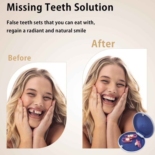 Custom Partial Dentures for Women with No Teeth, Temporary Dentures for Men, Removable Dentures for Tooth, Personalized Replacement Teeth, Adjustable & Comfortable, Easy to Use (1 Tooth)