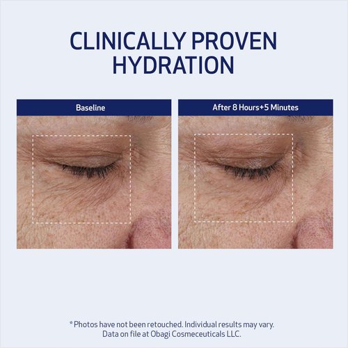 SUZANOBAGIMD Moisture Restore – Medical-Grade Multi-Layered Moisture Provides Redness Relief, Long-Lasting Hydration + Improves Skin Texture & Firmness – Suitable for All Skin Types – 1.7 oz