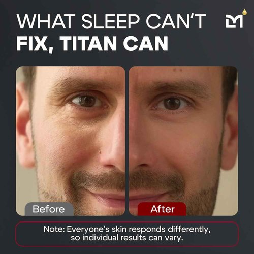 Man Labs Titan Peptide Anti-Aging Under Eye Gel for Men – Reduce Appearance of Puffiness, Dark Circles, Eye Bags, & Sagging – DMAE, Niacinamide, Hyaluronic Acid, Peptides – All Skin Types – Unscented