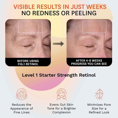 Fig.1 Retinol Night Cream Refill | Face Hydrating Moisturizer With Retinol & Squalane | Night Cream For Women With Sensitive Skin | Dermatologist Tested Wrinkle Reduction | 50ml