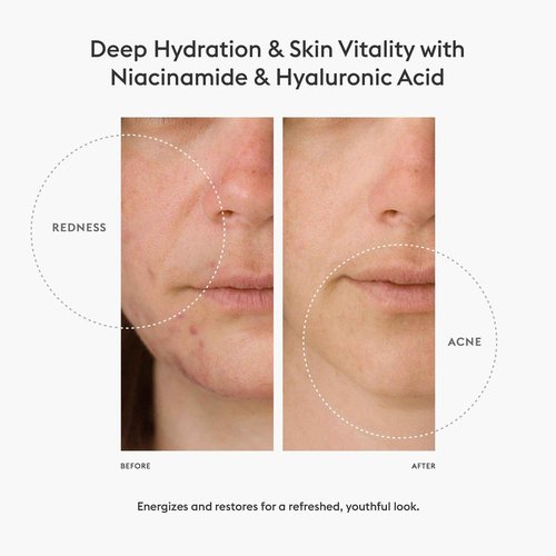 AMEON Supreme Energy Frozen Essence Ice Cubes - At-Home Cryotherapy for Firm, Hydrated, Radiant Skin and Reducing Acne and Post-Acne Scars