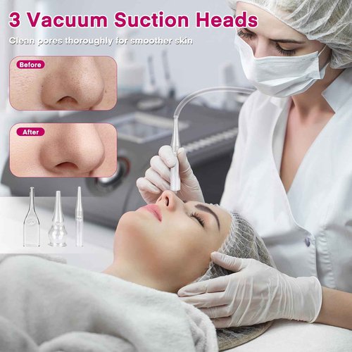 Diamond Micro-Dermabrasion Machine, Yofuly 3 in 1 Professional Dermabrasion Facial Machine with Two Spray Bottle and Vacuum Tube, Exfoliation Skin Care Face Beauty Device for Salon Spa Home Use, Pink