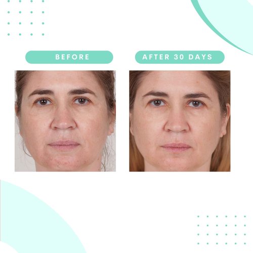 Serious Skincare Glycolic Acid Serum & Face Moisturizer Cream, Facial Renewal Skin Care Set, Exfoliating, Hydrating, Refine Texture, Lines, Pores, Discoloration, Skin Balancing Blue Tansy - Anti-Aging