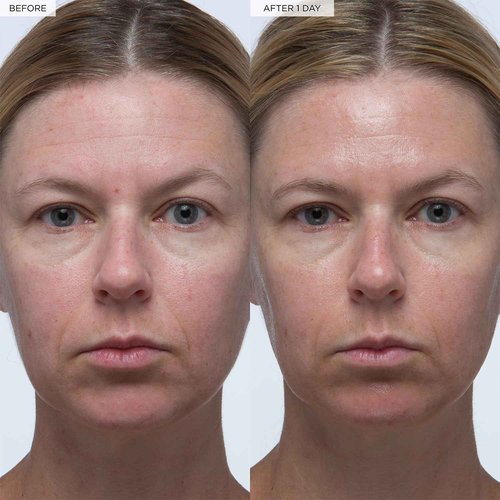 Glow Recipe Hydrate + Plump Duo - Watermelon Glow Niacinamide Dew Drops (40 ml) & Plum Plump Hyaluronic Serum (30 ml) - Korean Skincare