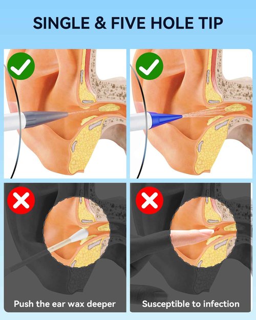 Electric Ear Wax Removal with 1080P Ear Camera, Water Powered Ear Cleaner with 4 Mode Settings, 10 Tips, Wireless Otoscope with 6 LED Lights, 8 PCS Earwax Removal Kit Set
