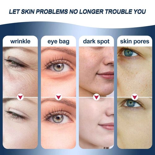 MiSMON High Frequency Facial Machines, 4 in 1 Facial Massager Micro-Current Light Therapy Device for Face