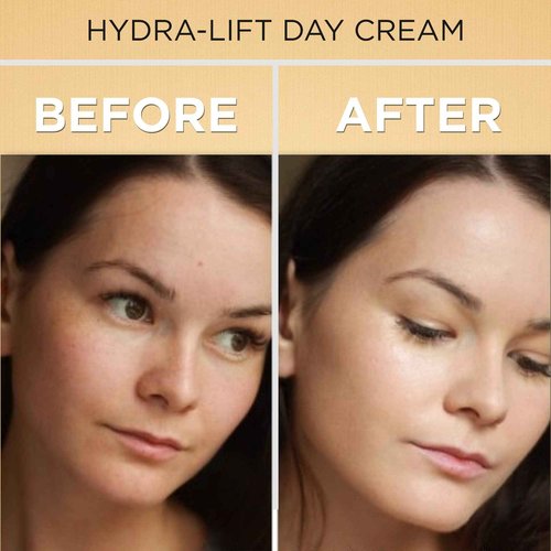 Shira Boto-Derm Rx Day Cream, 1.35 fl oz, Anti-Aging and Anti-Wrinkle Cream for Women, Skin Tightening Cream, Anti-Aging Skin Care and Wrinkle Treatment