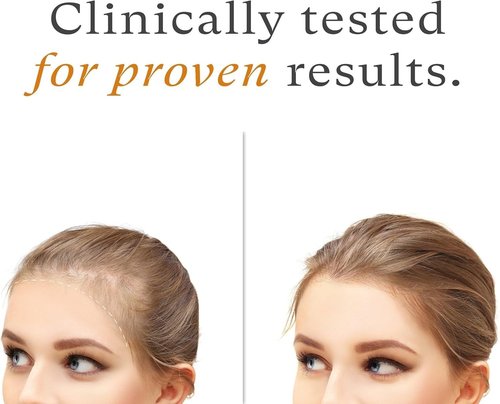 OBOGEE Women's Balance Hair Growth Supplements Proven Hair Supplement for Visibly Thicker Hair and Scalp Coverage, Dermatologist (1 PACK) (Pack, 240, Count)