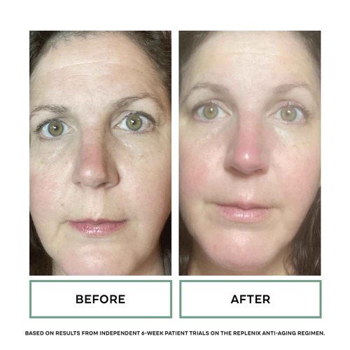 Replenix Pure Hydration Hyaluronic Acid Serum - Medical Grade Anti-Aging Treatment, Reduces Appearance of Wrinkles, Uneven Skin Tone, Firming, 1 oz.