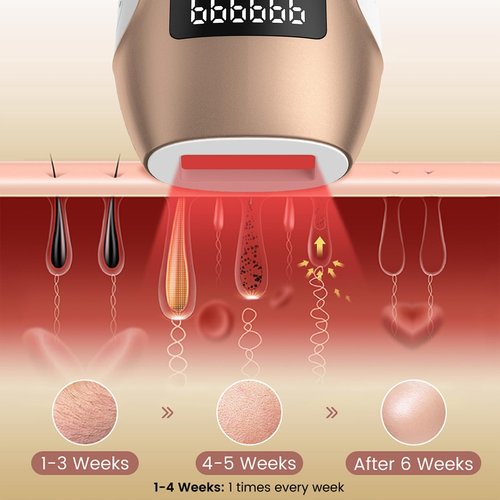 FELOOW IPL Hair Removal Device, Hair Removal for Women and Men at home for Armpits Legs Arms Bikini Line，model S3