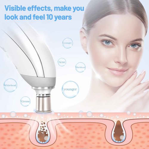 mcwdoit Facial Microdermabrasion, Diamond Dermabrasion Machine for Skin Exfoliation Blackhead Removal,Portable Rechargeable USB Cleansing Cordless White Home Device for Girl Women as a Gift, Upgraded