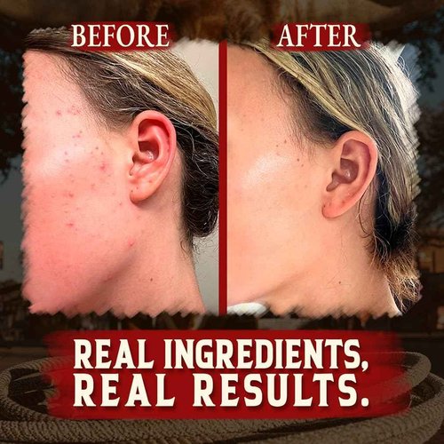 Organic Beef Tallow for Skin - 4 OZ (Pack of 3) — Grass Fed Beef Tallow for face + Body — US-Made Whipped Tallow and Honey Balm Moisturizer for Dry and Sensitive Skin, Eczema, Rosacea (No Additives)