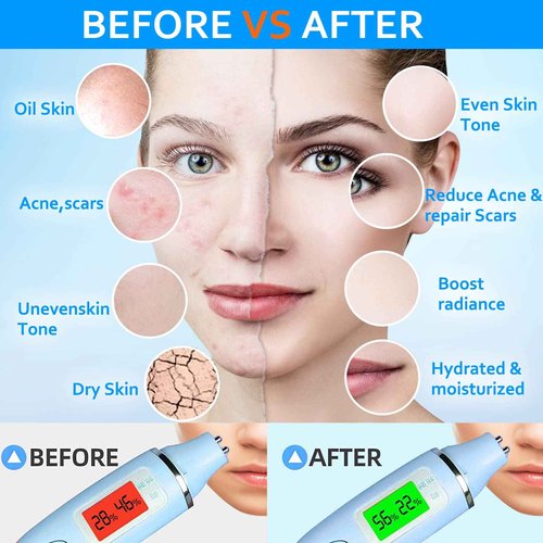 Ouhans Jelly Mask Powder for Facials Care,Hyalorunic Acid 24k Gold Aloe Vera Jelly Masks for Facials Professional