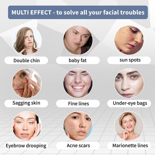 PCL Cog Threads 4D COG PDO Thread for Face Lifting 360R Bidirectional Barb (Blunt-Type) PCL Threads for Face/Whole Body Lift 19G100mm 10pcs