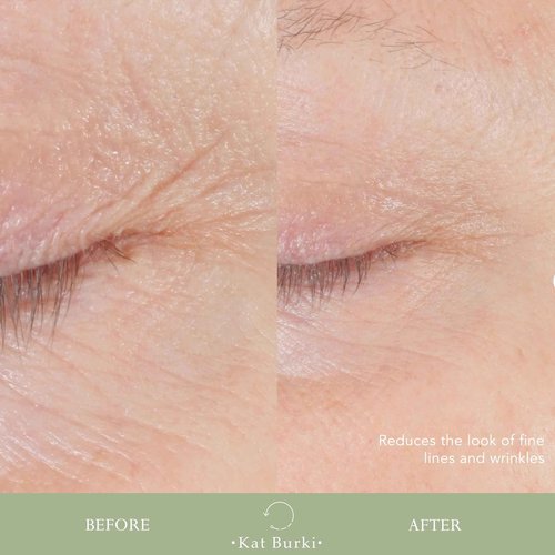 Kat Burki Form Control Marine Collagen Face Serum. Clinically Proven Anti-Aging Care Promoting Collagen Production: Lifts, Plumps & Contours Skin - 0.5 Fl Oz