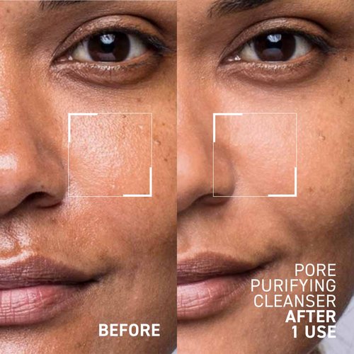 Dr. Brandt Pores No More, Pore Purifying Cleanser - Non-Drying Gel - Helps to Minimize the Appearance of Pores & Dissolves Impurities - 3.5 fl oz, Pack of 2