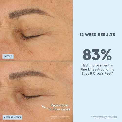 NuFACE Super Peptide Booster Face Serum - Skin Firming Peptide Serum for Fine Lines and Wrinkles - IonPlex Skin Care to Smooth, Hydrate & Enhance your NuFACE Microcurrent Facial Device Results (1 oz)