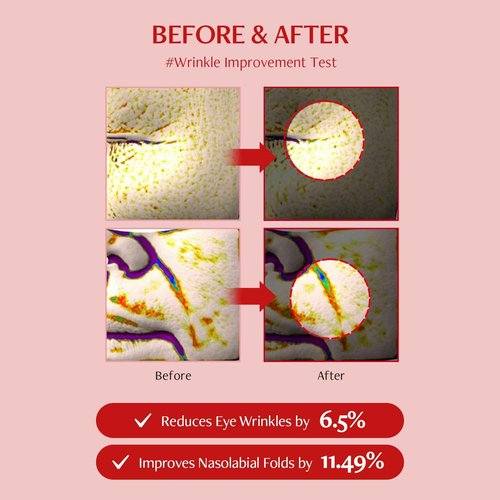 Shumage Gold Seal Lifting Cream+Device & Shumage Shot Gold Seal Lifting Ampoule - Moisturizer Face Lift Cream, Hydrating & Tightening for Sagging Skin - Collagen Serum for Radiant Glow