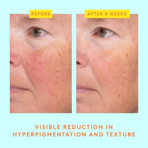 Drunk Elephant C-Luma Hydrabright Serum - 30 ml/1 fl oz - 10% Hydrating Vitamin C - Clean Clinical Skincare - Cruelty-Free - Dermatologist-Tested - Free of Essential Oils, Silicones, and Fragrance