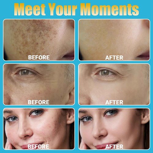 Home Use Microneedling Microneedle Skin Care Beauty Kit Tool for Face Hair Beard