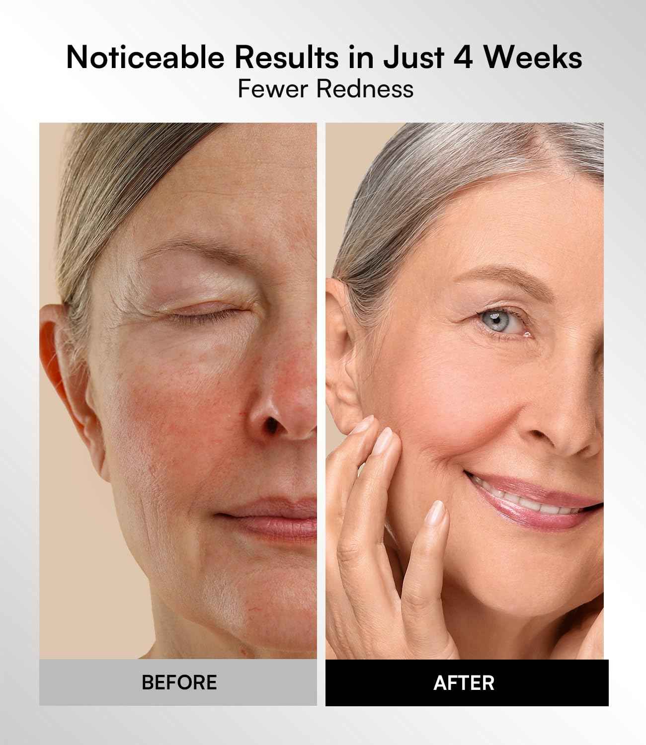 INIA Red Light Therapy Mask for Face – 4 Light Modes with 850nm NIR, Red & Blue LED Light Therapy, 2600mAh Rechargeable LED Face Mask for Radiant Glow at Home, Black