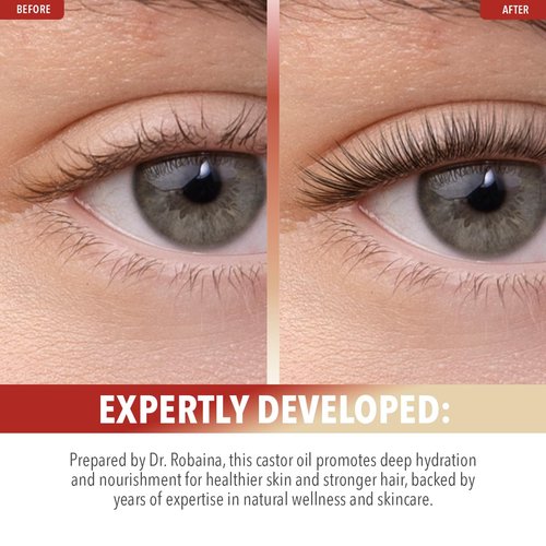 Dr. Robaina Organic Castor Oil – Cold-Pressed for Hair Growth, Eyelash & Eyebrow Care, Skin Hydration & Nail Strength – Pure Vegan Moisturizer – Made in USA, 4 oz