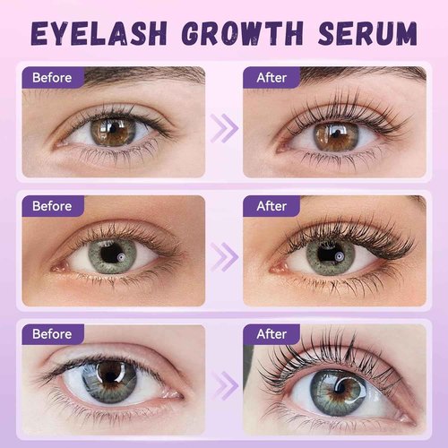 Eyelash Growth Serum, Premium Lash Serum Promotes Longer, Thicker（Gold）