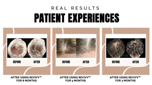 REVIVV Women Hair Growth Serum, 100% Natural Growth Products, Topical Solution for Visibly Thicker & Fuller Hair, Dermatologist Recommended, 1-Pack, 1oz Bottle, 45-Day Supply