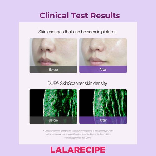 LALARECIPE Bakuchiol First Essence – Hydrating Milky Korean Toner with Retinol Liposome, Shea Butter & Peptides – Vegan Skincare for Wrinkle Care & Elasticity (5.24 fl oz)