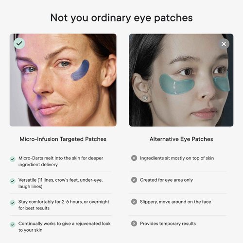 Qure Micro-Infusion Anti Wrinkle Patches for Smile Line, Frown lines, Under Eye Bags, Puffiness, Crow's Feet - Retinol, Caffeine, Peptides - Dissolvable for Overnight Use - 8 Pairs