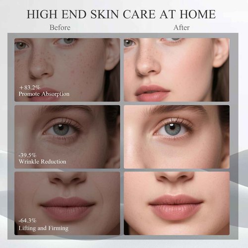 BNU Facial Lift Device, 3-in-1 Light Therapy Beauty Massager for Wrinkle, Lifting, Firming, Puffiness Reduction and Promote Absorption, 4 Level Skin Tightening Machine for Face, Neck and Eye