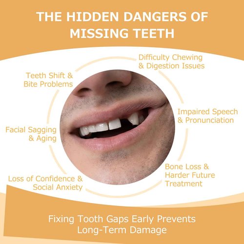 Partial Dentures - Dentures for Missing Teeth & Gaps - Lightweight & Unbreakable Replacement Teeth for Men & Women (1 Tooth)