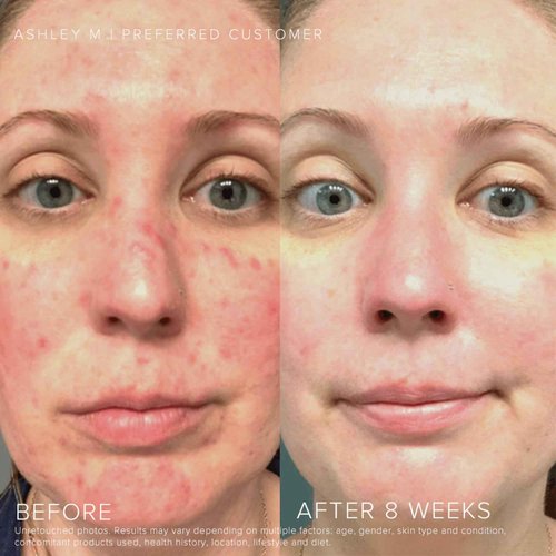 Rodan + Fields Soothe Daily Mineral Sunscreen SPF 30 | 1 Fl Oz | SPF Moisturizer for Face | Zinc Oxide Sunblock | Travel Size Sun Protection Skincare