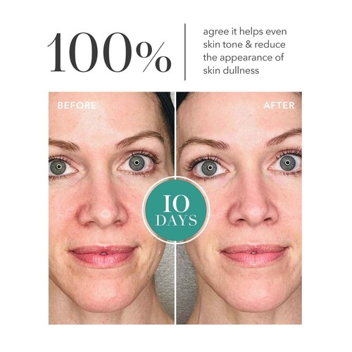 Algenist GENIUS Liquid Collagen Essence - Liquid Collagen Serum with Patented Alguronic Acid to Help Improve Skin Bounce, Elasticity & Radiance (3.4 oz)