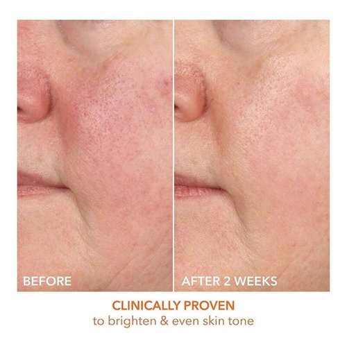 Dr Dennis Gross Vitamin C Lactic 15% Firm & Brighten Serum: Visibly Improve Signs of Aging, 1 oz