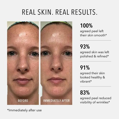 HydroPeptide Polish & Plump Face Peel Radiant Two-Step System, Boosts Firmness and Plumpness, 1 Set