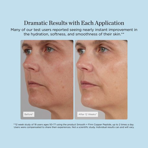 Smooth + Firm Copper Peptide Concentrate Serum for Aging Skin, Plumping Niacinamide for Tightening & Brightening, Helps Improve Elasticity, Hyperpigmentation & Dark Spots, Water Based, 1.18 Fl Oz