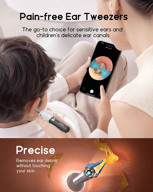 Bebird Earsight Plus R37R Ear Cleaning Camera Wax Removal Tool kit, Flexible Ear Scope Otoscope Camera Light, Visual Ear Picker Wireless Earwax Remover Tweezers for Family