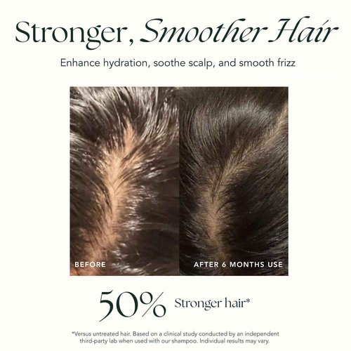 RANAVAT BOTANICS RANAVAT Mighty Majesty - Fortifying Hair Serum - Hair Oil Serum for Scalp Hydration, Frizz Control, & Hair Shine - With Jasmine and Amla Extract (1.7 oz)