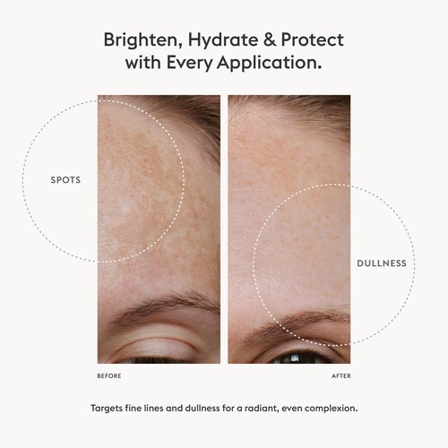 AMEON Aurora Glow Serum - Turbocharged Vitamin C Serum for Radiant, Youthful, and Brightened Skin with Anti-Aging Benefits for Acne-prone skin