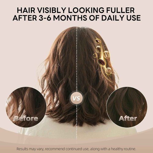 ALFHEIM Coffee+ Thickening Shampoo & Conditioner Set for Fine, Thin & Weak Hair with Caffeine, Biotin & Arabica Coffee Oil – Strengthening, Moisturizing & Volumizing Duo – Sulfate-Free – 33.8 oz × 2