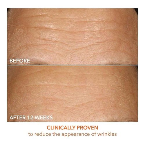 Dr Dennis Gross Vitamin C Lactic 15% Firm & Brighten Serum: Visibly Improve Signs of Aging, 1 oz