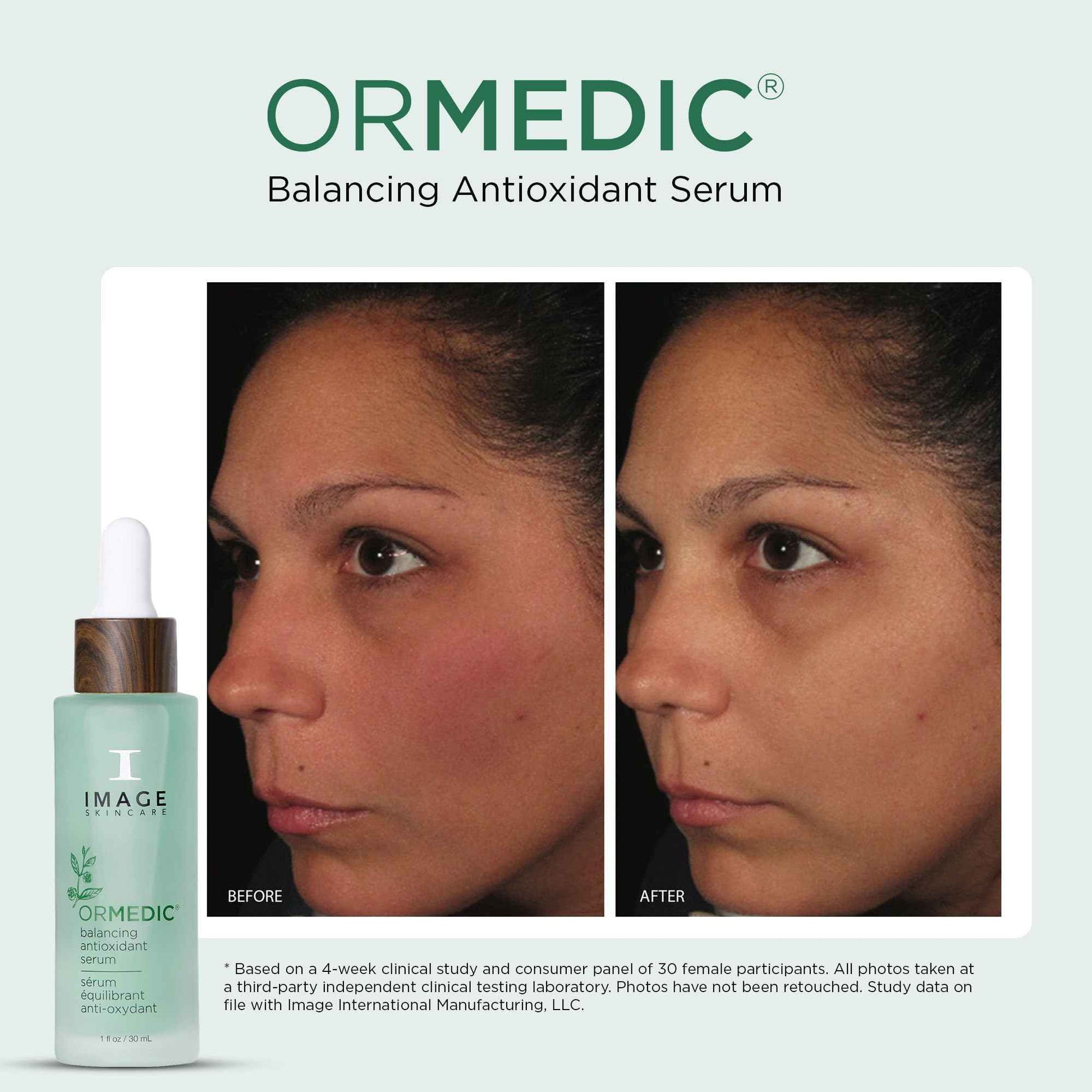IMAGE Skincare, ORMEDIC Balancing Antioxidant Serum, Hydrates & Soothes Skin with Organic Aloe Vera, Vitamin C, & Botanical Extracts, 1 fl oz