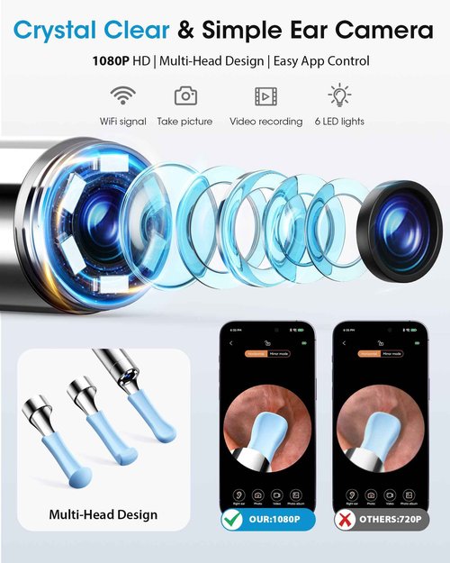 Ear Wax Removal Kit with Camera – Ear Cleaner Tool for Safe & Effective Ear Care – Includes Ear Camera for Visual Inspection & Gentle Ear Irrigation System – Complete Ear Cleaning Solution